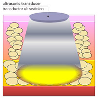 Ultrasonic transducer